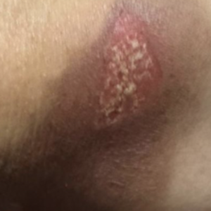 18/04